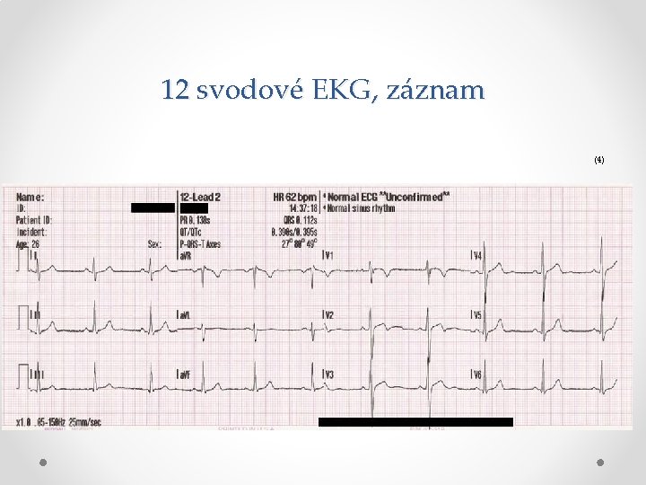 12 svodové EKG, záznam (4) 