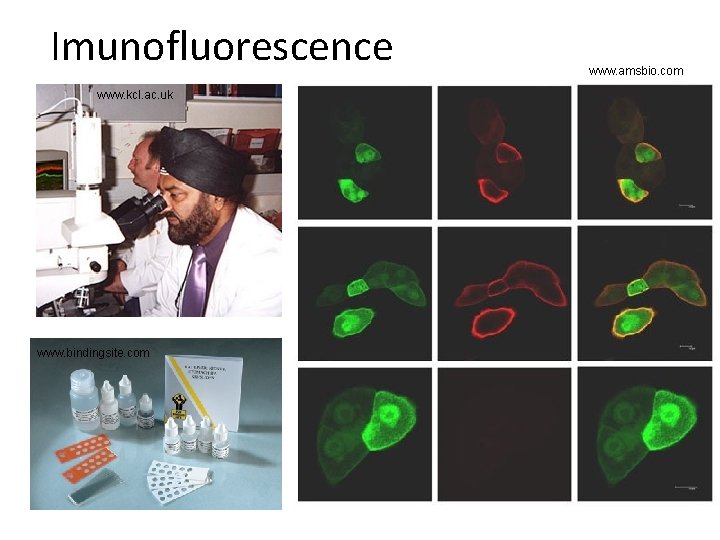 Imunofluorescence www. kcl. ac. uk www. bindingsite. com www. amsbio. com 