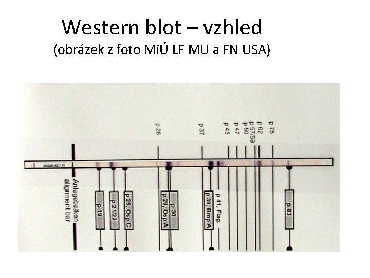Western blot – vzhled (obrázek z foto MiÚ LF MU a FN USA) 