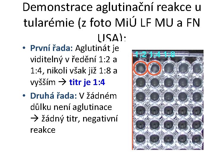 Demonstrace aglutinační reakce u tularémie (z foto MiÚ LF MU a FN USA): •