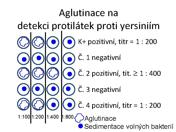 Aglutinace na detekci protilátek proti yersiniím K+ pozitivní, titr = 1 : 200 Č.