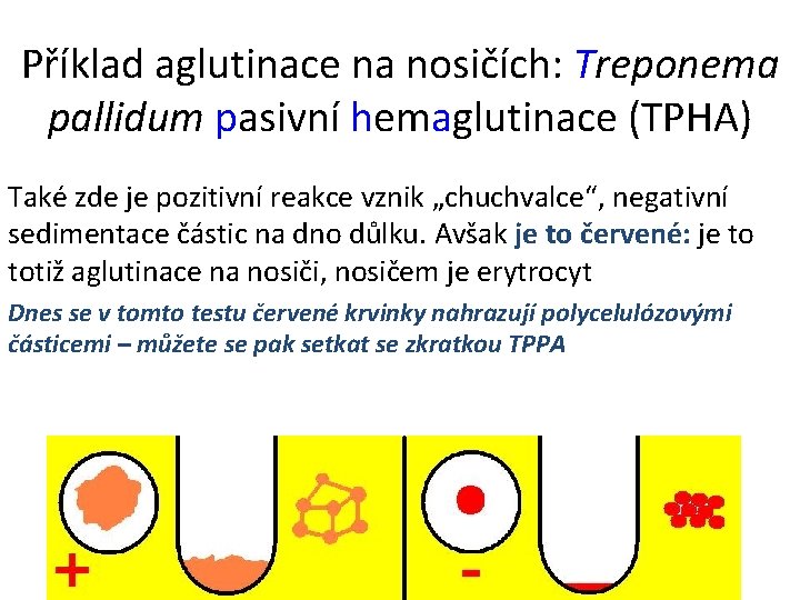 Příklad aglutinace na nosičích: Treponema pallidum pasivní hemaglutinace (TPHA) Také zde je pozitivní reakce