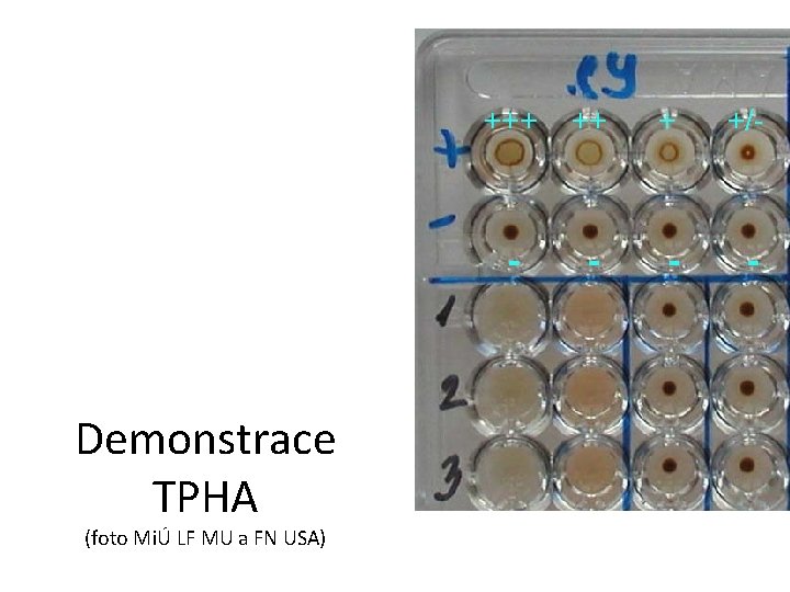 +++ ++ + +/- - - Demonstrace TPHA (foto MiÚ LF MU a FN