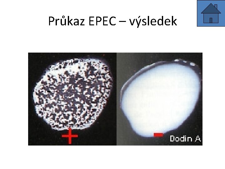 Průkaz EPEC – výsledek 