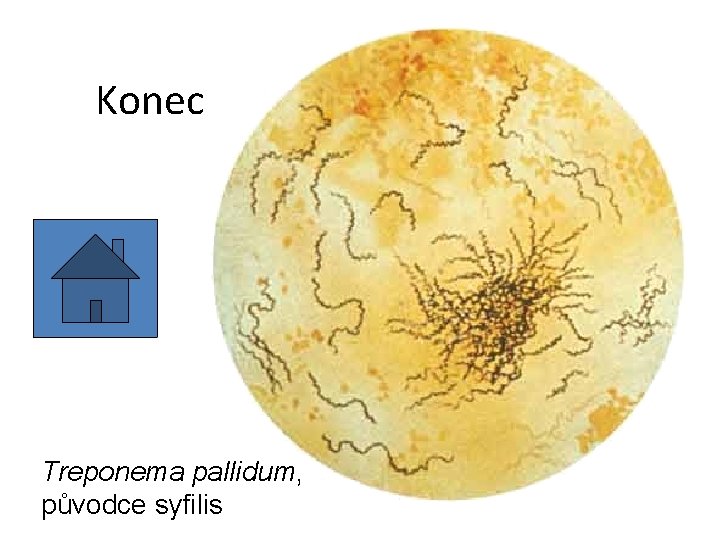 Konec Treponema pallidum, původce syfilis 