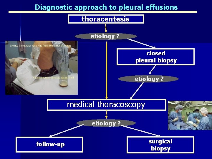 Diagnostic approach to pleural effusions thoracentesis etiology ? closed pleural biopsy etiology ? medical