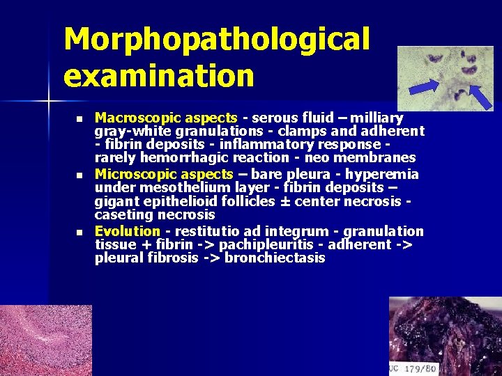 Morphopathological examination n Macroscopic aspects - serous fluid – milliary gray-white granulations - clamps
