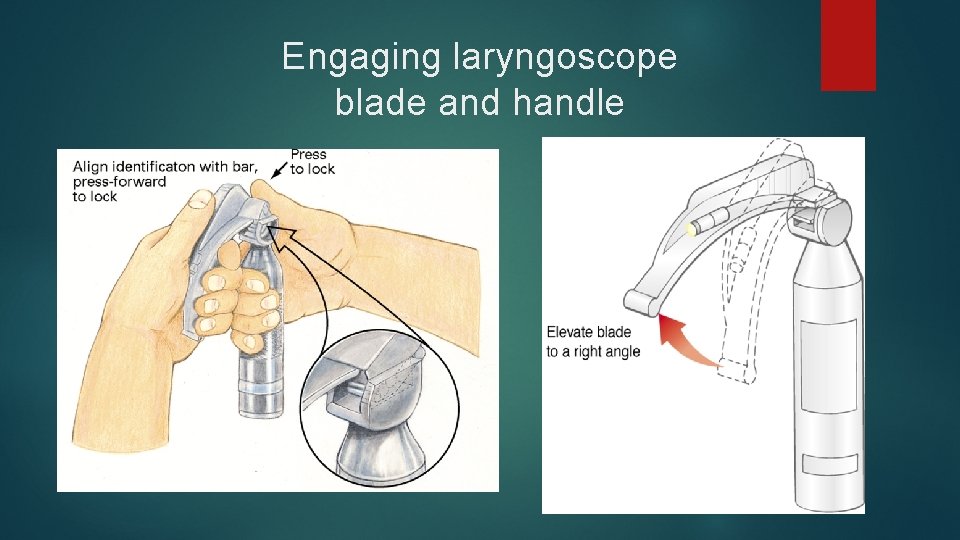 Engaging laryngoscope blade and handle 
