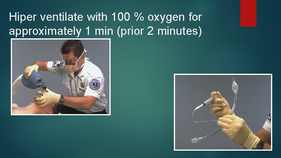 Hiper ventilate with 100 % oxygen for approximately 1 min (prior 2 minutes) 