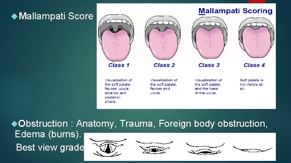  Mallampati Obstruction Score : : Anatomy, Trauma, Foreign body obstruction, Grade 1 Edema