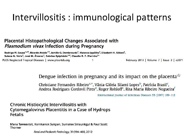 Intervillositis : immunological patterns 