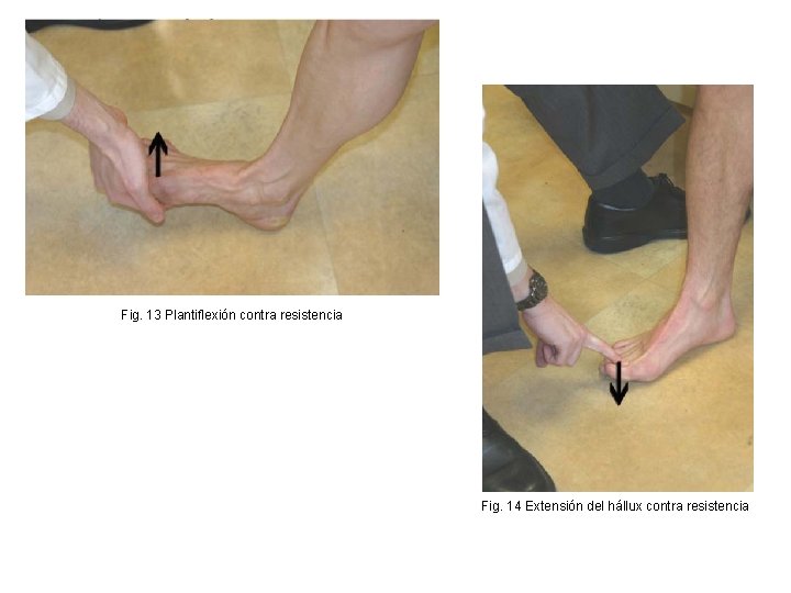 Fig. 13 Plantiflexión contra resistencia Fig. 14 Extensión del hállux contra resistencia 