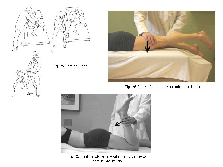Fig. 25 Test de Ober Fig. 26 Extensión de cadera contra resistencia Fig. 27