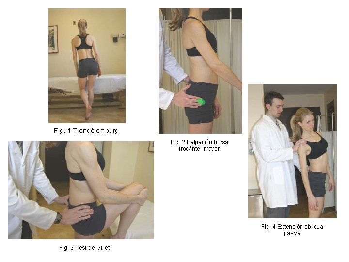 Fig. 1 Trendélemburg Fig. 2 Palpación bursa trocánter mayor Fig. 4 Extensión oblicua pasiva