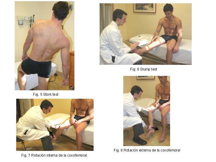 Fig. 6 Slump test Fig. 5 Stork test Fig. 8 Rotación externa de la