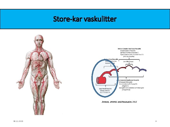 Store-kar vaskulitter Jennette, Arthritis and Rheumatism 2012 09. 11. 2020 8 