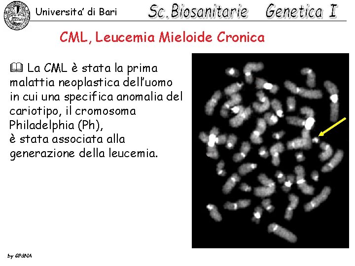 Universita’ di Bari CML, Leucemia Mieloide Cronica & La CML è stata la prima