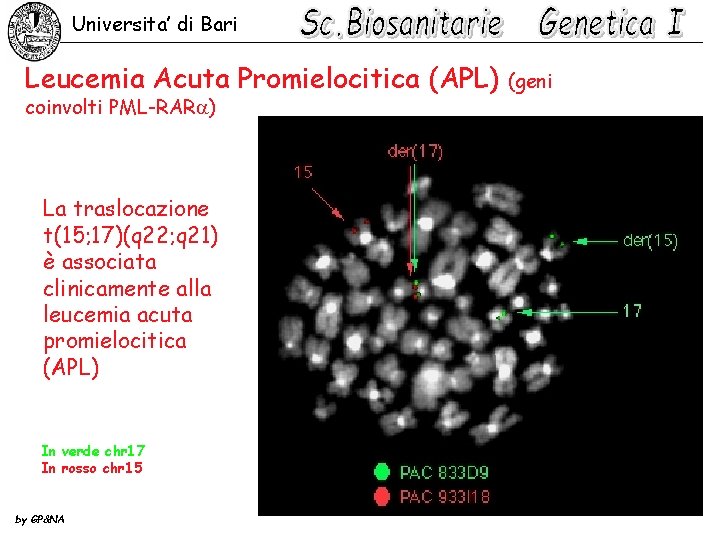 Universita’ di Bari Leucemia Acuta Promielocitica (APL) coinvolti PML-RAR ) La traslocazione t(15; 17)(q