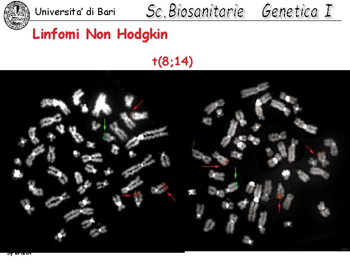Universita’ di Bari Linfomi Non Hodgkin t(8; 14) by GP&NA 