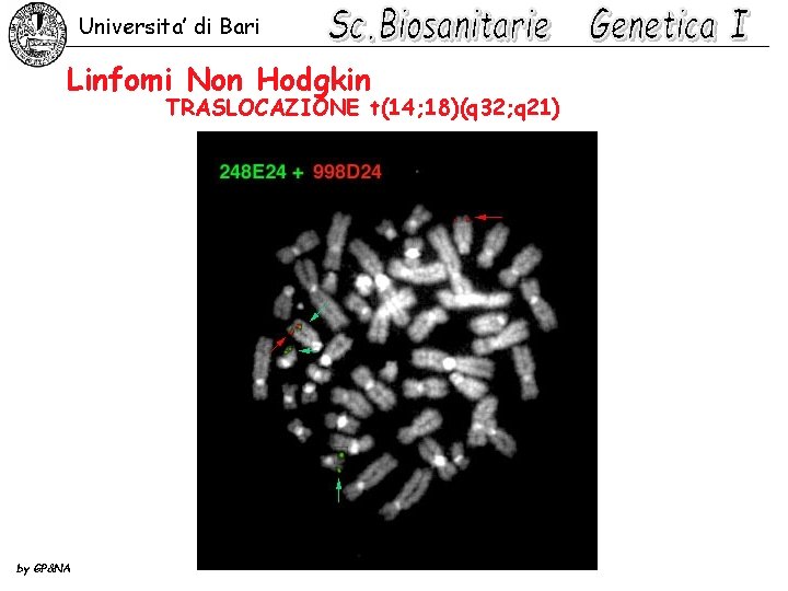 Universita’ di Bari Linfomi Non Hodgkin TRASLOCAZIONE t(14; 18)(q 32; q 21) by GP&NA