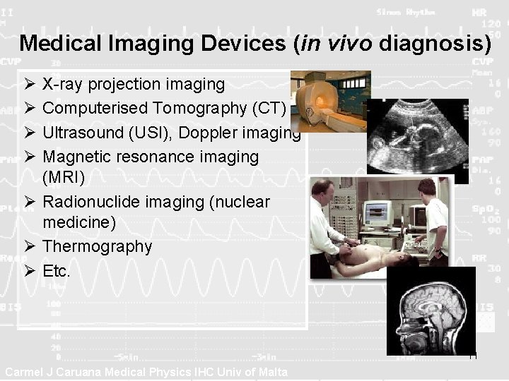 Medical Imaging Devices (in vivo diagnosis) Ø Ø X-ray projection imaging Computerised Tomography (CT)