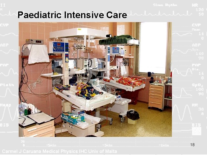Paediatric Intensive Care 18 Carmel J Caruana Medical Physics IHC Univ of Malta 