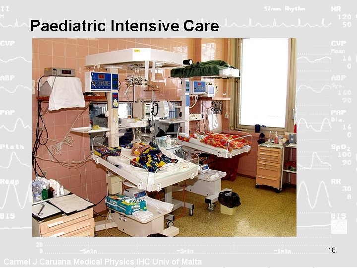 Paediatric Intensive Care 18 Carmel J Caruana Medical Physics IHC Univ of Malta Paediatric Intensive Care 18 Carmel J Caruana Medical Physics IHC Univ of Malta