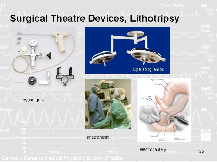Surgical Theatre Devices, Lithotripsy Operating lamps cryosurgery anaesthesia electrocautery Carmel J Caruana Medical Physics Surgical Theatre Devices, Lithotripsy Operating lamps cryosurgery anaesthesia electrocautery Carmel J Caruana Medical Physics