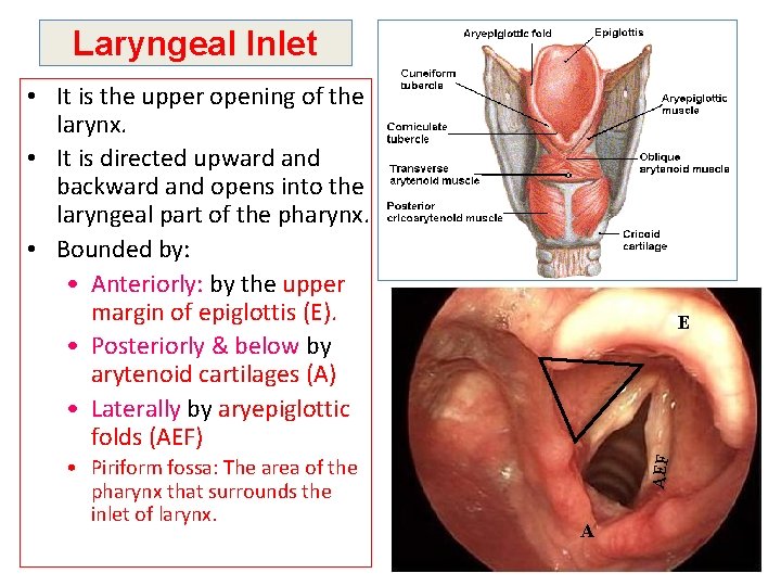 Laryngeal Inlet • It is the upper opening of the larynx. • It is