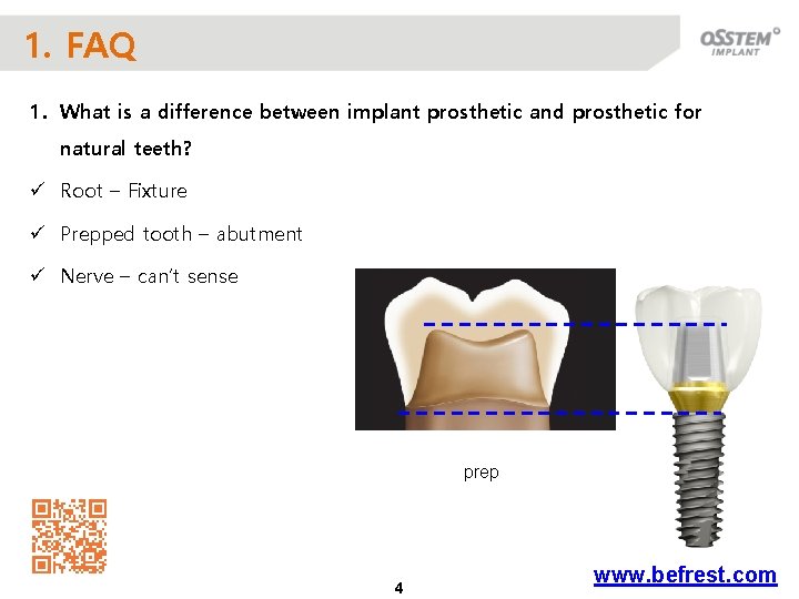 1. FAQ 1. What is a difference between implant prosthetic and prosthetic for natural
