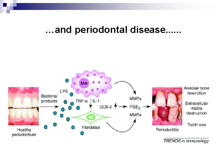 …and periodontal disease. . . 