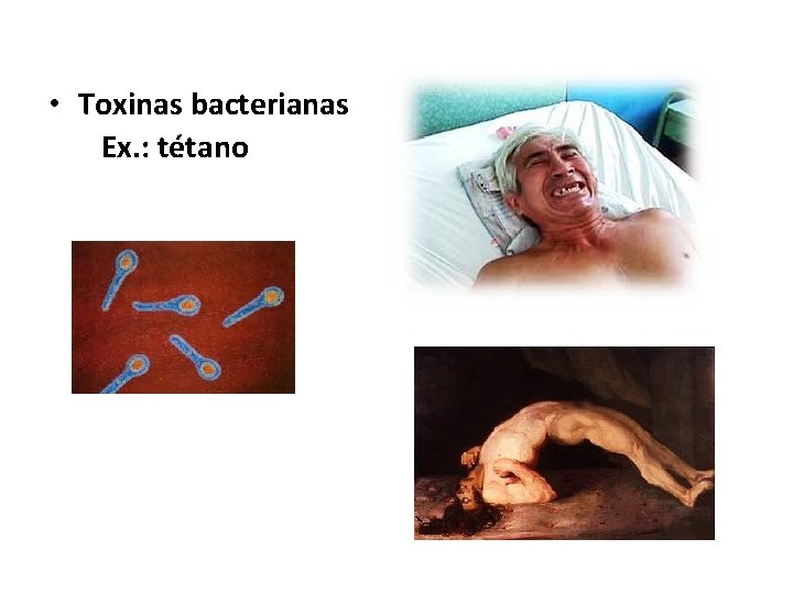  • Toxinas bacterianas Ex. : tétano 