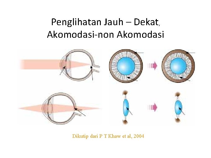 Penglihatan Jauh – Dekat, Akomodasi-non Akomodasi Dikutip dari P T Khaw et al, 2004