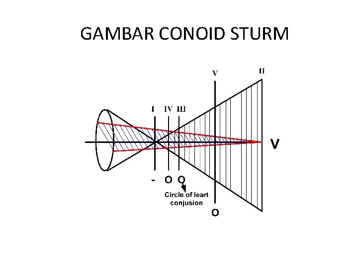 GAMBAR CONOID STURM 