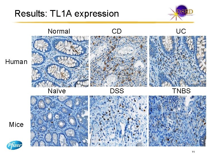 Results: TL 1 A expression Normal CD UC Naïve DSS TNBS Human Mice 11