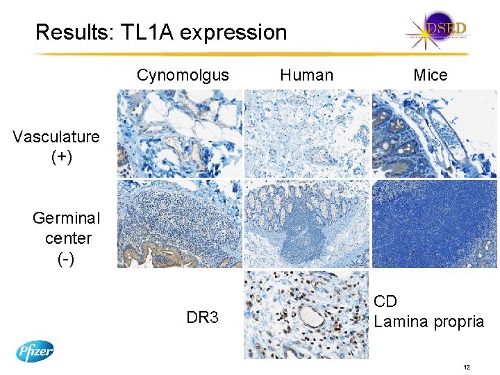 Results: TL 1 A expression Cynomolgus Human Mice Vasculature (+) Germinal center (-) DR