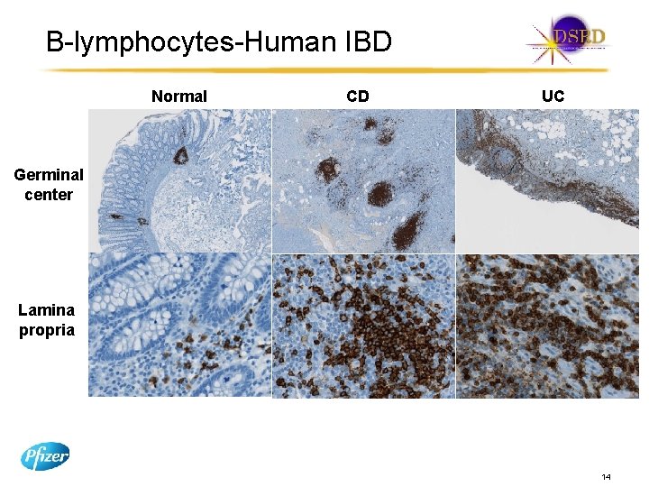 B-lymphocytes-Human IBD Normal CD UC Germinal center Lamina propria 14 