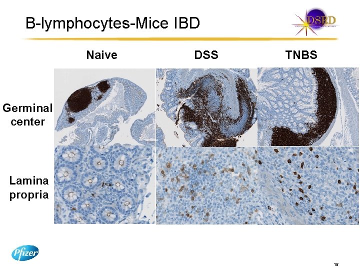 B-lymphocytes-Mice IBD Naive DSS TNBS Germinal center Lamina propria 15 