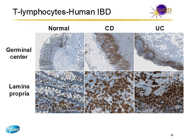 T-lymphocytes-Human IBD Normal CD UC Germinal center Lamina propria 16 