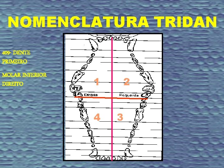 NOMENCLATURA TRIDAN 409 - DENTE PRIMEIRO MOLAR INFERIOR DIREITO 1 4 2 3 