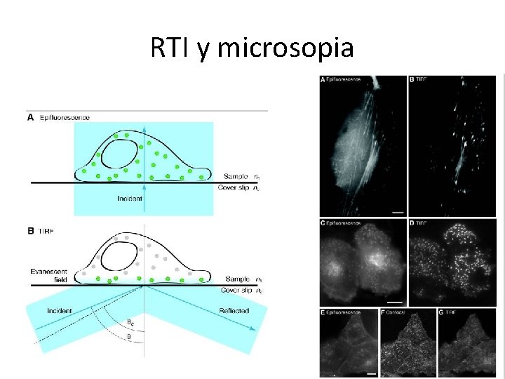 RTI y microsopia 