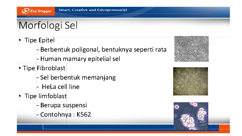 Morfologi Sel • Tipe Epitel - Berbentuk poligonal, bentuknya seperti rata - Human mamary