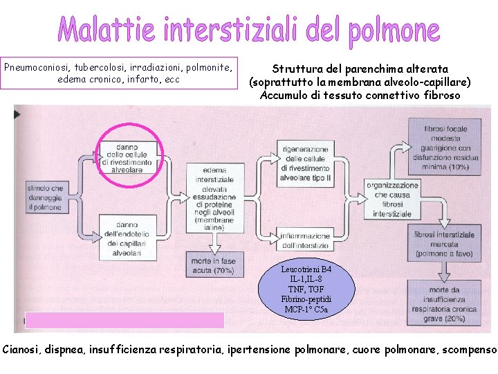 Pneumoconiosi, tubercolosi, irradiazioni, polmonite, edema cronico, infarto, ecc Struttura del parenchima alterata (soprattutto la