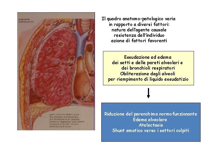 Il quadro anatomo-patologico varia in rapporto a diversi fattori: natura dell’agente causale resistenza dell’individuo