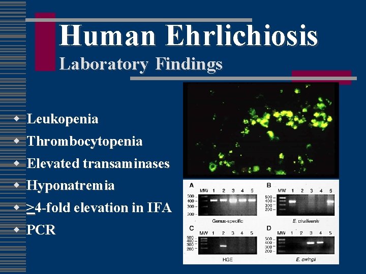 Human Ehrlichiosis Laboratory Findings w w Leukopenia Thrombocytopenia w Elevated transaminases w Hyponatremia w