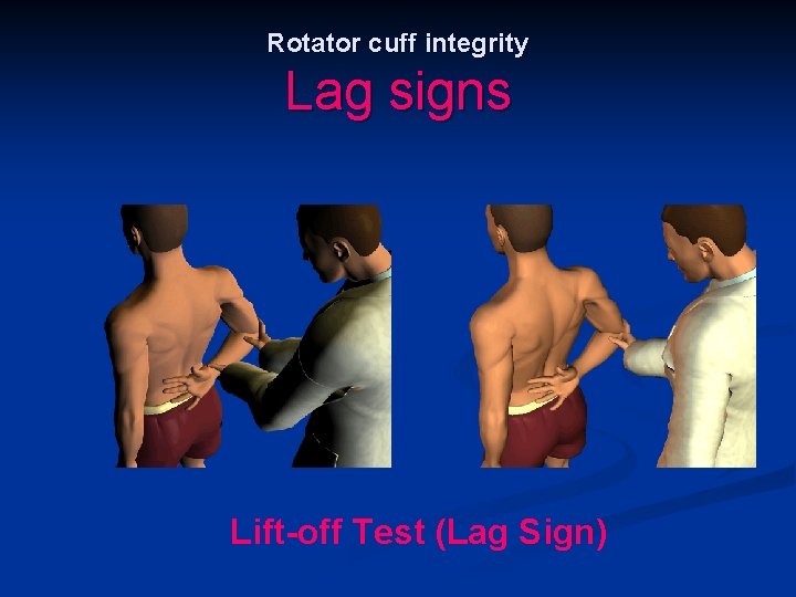 Rotator cuff integrity Lag signs Lift-off Test (Lag Sign) 