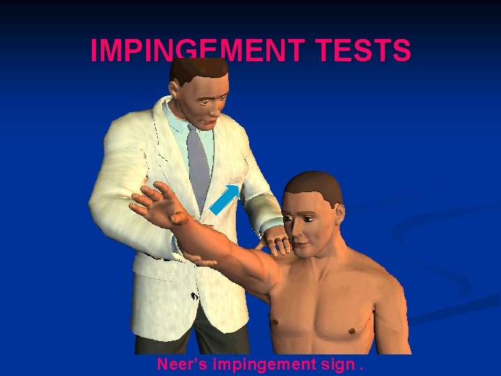 IMPINGEMENT TESTS Neer’s impingement sign. 