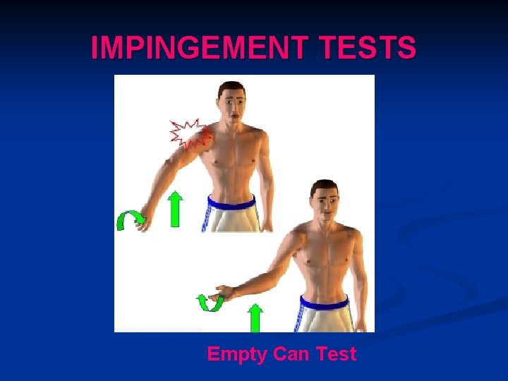 IMPINGEMENT TESTS Empty Can Test 