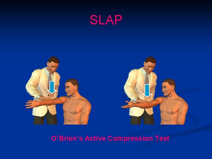 SLAP O’Brien’s Active Compression Test 