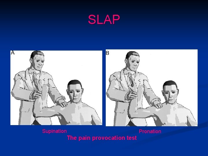 SLAP Supination The pain provocation test Pronation 